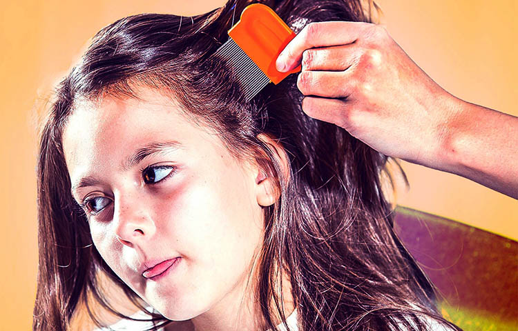 mi hijo tiene piojos