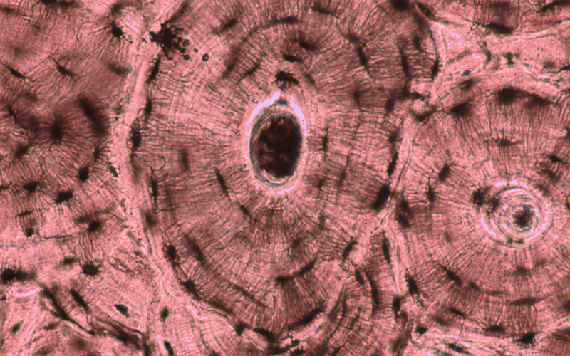Diferencias entre el conducto de Volkmann y el conducto de Havers