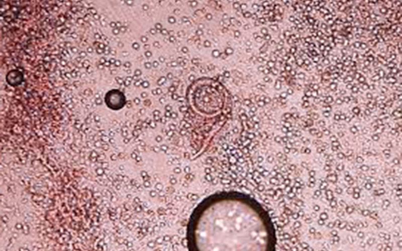 Qué síntomas y qué es la verminosis