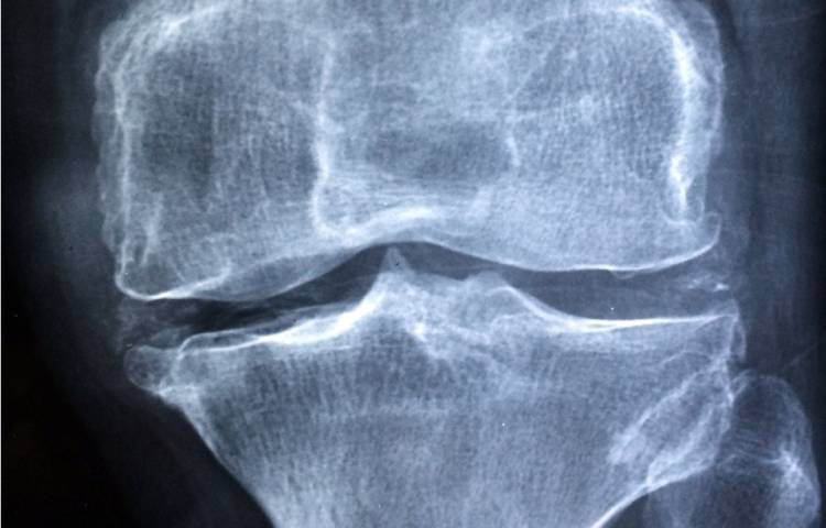 Datos interesantes del calcio